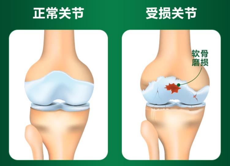 夏季关节养护必知，move free不同颜色功效解读