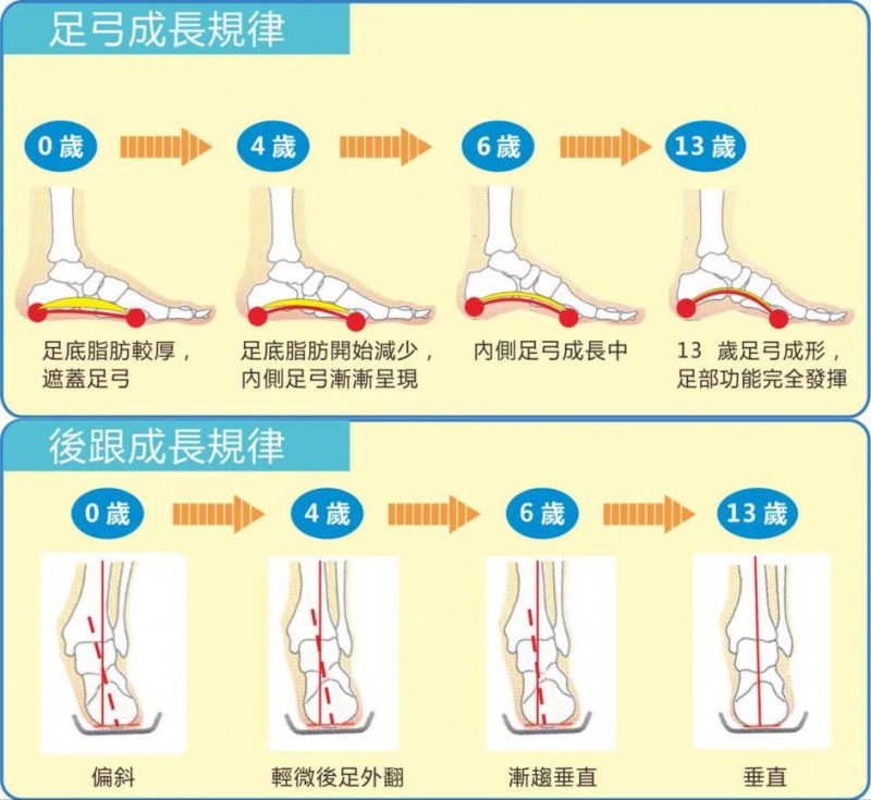 正确穿着矫正鞋垫，应了解这些知识点