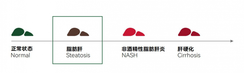 瘦子也会得脂肪肝？LAIFE「乐轻肝」：科学护肝新选择！