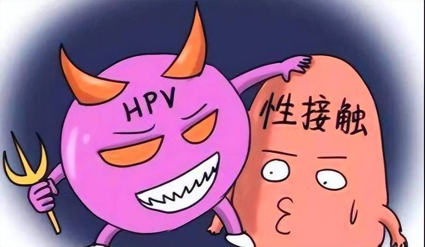 艾拉光动力治疗hpv多少钱一次？光动力三次后复发率高吗？