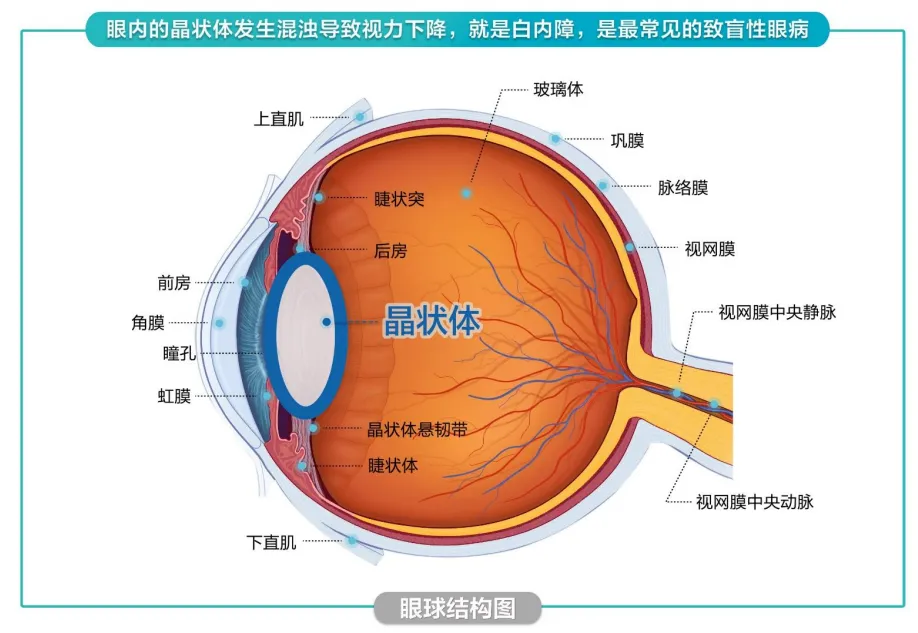 北京爱尔英智眼科医生提醒：提前了解这些致盲性眼病很关键！